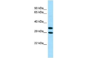 WB Suggested Anti-AKR1A1 Antibody Titration: 1. (AKR1A1 anticorps  (C-Term))