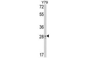 Image no. 1 for anti-CUE Domain Containing 2 (CUEDC2) (C-Term) antibody (ABIN452895) (CUEDC2 anticorps  (C-Term))