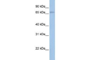 WB Suggested Anti-MAP3K2 Antibody Titration:  0. (MAP3K2 anticorps  (N-Term))