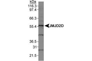 Western blot analysis of JMJD2D in HeLa nuclear extracts using JMJD2D polyclonal antibody . (JMJD2D anticorps  (AA 460-520))