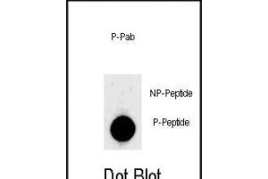 Dot blot analysis of anti-Phospho-LIN28- Phospho-specific Pab (ABIN650868 and ABIN2839816) on nitrocellulose membrane.