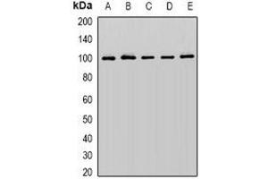 Western blot analysis of Cullin 5 expression in K562 (A), PC3 (B), SW480 (C), mouse brain (D), mouse heart (E) whole cell lysates. (Cullin 5 anticorps)