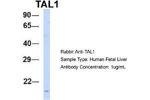 Host: Rabbit Target Name: TAL1 Sample Type: Human Fetal Liver Antibody Dilution: 1. (TAL1 anticorps  (N-Term))