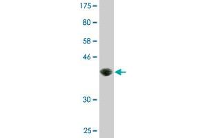 Western Blot detection against Immunogen (37.