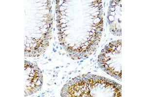 Immunohistochemistry of paraffin-embedded human colon using CCL2 antibody at dilution of 1:100 (40x lens). (CCL2 anticorps)