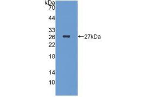 Figure. (ICA1 anticorps  (AA 1-258))