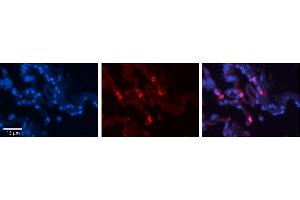 Rabbit Anti-HLA-F Antibody     Formalin Fixed Paraffin Embedded Tissue: Human Lung Tissue  Observed Staining: Membrane and cytoplasmic in alveolar type I cells  Primary Antibody Concentration: 1:100  Secondary Antibody: Donkey anti-Rabbit-Cy3  Secondary Antibody Concentration: 1:200  Magnification: 20X  Exposure Time: 0. (HLA-F anticorps  (N-Term))