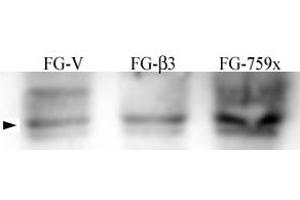 FG Pancreatic Carcinoma Cell stably expressing vector along (FG-V) the b3 integrin subunit (FG-b3) or a b3 truncation mutant (FG-759x). (Src anticorps  (pTyr215))