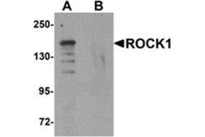 Western blot analysis of ROCK1 in 293 cell lysate with ROCK1 antibody at 1 μg/ml in (A) the absence and (B) the presence of blocking peptide.