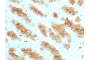Formalin paraffin rat stomach with Acidic Cytokeratin antibody (KRTL/1077). (Keratin Acidic (AE1) anticorps)