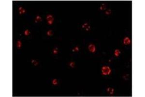 Immunofluorescence of AES in Hela cells with AES antibody at 20 µg/ml (AES anticorps  (C-Term, N-Term))