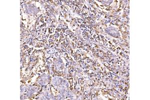 IHC analysis of Epac1/RAPGEF3 using anti-Epac1/RAPGEF3 antibody (ABIN7601858). (RAPGEF3 anticorps  (AA 49-881))