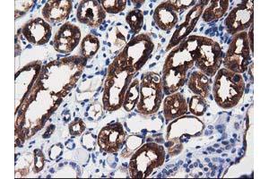 Immunohistochemical staining of paraffin-embedded Human liver tissue using anti-ALDH1L1 mouse monoclonal antibody. (ALDH1L1 anticorps)