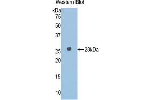 Western blot analysis of the recombinant protein. (A1BG anticorps  (AA 220-415))