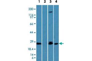 Western blot analysis of TICAM2 in the (Lane 1) absence and (Lane 2) presence of immunizing peptide in human lung, (Lane 3) mouse lung and (Lane 4) rat lung lysate using TICAM2 polyclonal antibody  at 1 ug/mL . (TICAM2 anticorps  (AA 87-103))