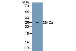Detection of Recombinant PRDX2, Human using Polyclonal Antibody to Peroxiredoxin 2 (PRDX2) (Peroxiredoxin 2 anticorps  (AA 2-198))