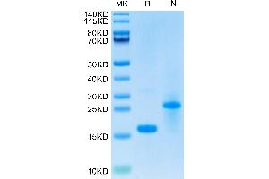 Growth Differentiation Factor 15 (GDF15) (AA 197-308) protein (His-Avi Tag,Biotin)