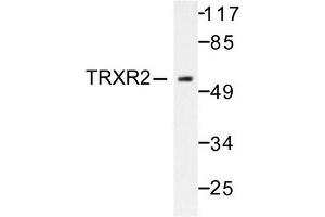 Image no. 1 for anti-Thioredoxin Reductase 2 (TXNRD2) antibody (ABIN271967) (TXNRD2 anticorps)