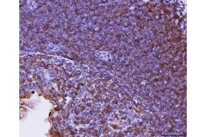 IHC analysis of Cxcr3 using anti-Cxcr3 antibody (ABIN7599273).