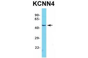 Host:  Rabbit  Target Name:  KCNN4  Sample Type:  HepG2  Antibody Dilution:  1. (KCNN4 anticorps  (C-Term))