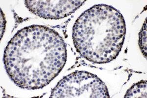 ADFP was detected in paraffin-embedded sections of rat testis tissues using rabbit anti- ADFP Antigen Affinity purified polyclonal antibody (Catalog # ) at 1 µg/mL.