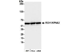 Western Blotting (WB) image for anti-Importin Subunit alpha-1 (KPNA2) (C-Term) antibody (ABIN7453571) (Importin Subunit alpha-1 (KPNA2) (C-Term) anticorps)
