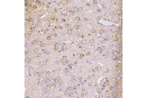 IHC analysis of PAK1 using anti-PAK1 antibody (ABIN7599852).