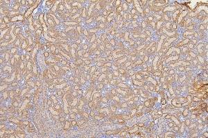 IHC analysis of SFRP1 using anti-SFRP1 antibody (ABIN6719484). (SFRP1 anticorps)