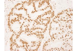 anti-Zinc Finger Protein 326 (ZNF326) (AA 532-582) antibody