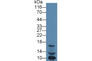 Detection of IGF1 in Human Lymphocyte lysate using Monoclonal Antibody to Insulin Like Growth Factor 1 (IGF1) (IGF1 anticorps  (AA 49-118))