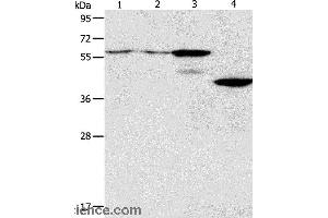 Western blot analysis of A375 and A172 cell, mouse pancreas tissue, human liver cancer tissue, using PGBD2 Polyclonal Antibody at dilution of 1:550 (PGBD2 anticorps)