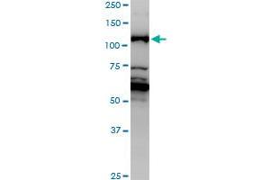 JMY monoclonal antibody (M01), clone 2D7.
