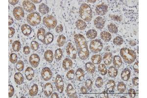 Immunoperoxidase of monoclonal antibody to TOMM20 on formalin-fixed paraffin-embedded human small Intestine.