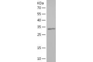 Western Blotting (WB) image for Hypocretin (Orexin) Receptor 1 (HCRTR1) (AA 1-46), (AA 244-297) protein (His-IF2DI Tag) (ABIN7123395)