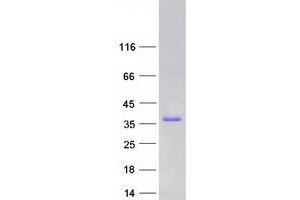 Validation with Western Blot