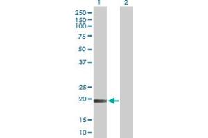 Western Blot analysis of TMEM134 expression in transfected 293T cell line by TMEM134 MaxPab polyclonal antibody. (TMEM134 anticorps  (AA 1-195))