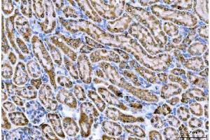 IHC analysis of CPT1A using anti-CPT1A antibody (ABIN7599853). (CPT1A anticorps  (AA 122-556))