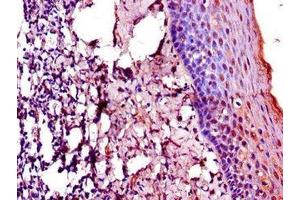 Immunohistochemistry of paraffin-embedded human tonsil tissue using ABIN7172803 at dilution of 1:100 (TACC3 anticorps  (AA 133-268))