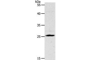 Western Blot analysis of Mouse liver tissue using NQO2 Polyclonal Antibody at dilution of 1:1200 (NQO2 anticorps)