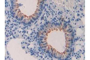 Detection of MIP1b in Mouse Lung Tissue using Polyclonal Antibody to Macrophage Inflammatory Protein 1 Beta (MIP1b) (CCL4 anticorps  (AA 24-92))