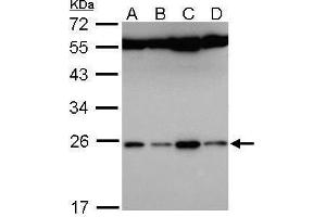 WB Image Sample (30 ug of whole cell lysate) A: Hela B: Hep G2 , C: Molt-4 , D: Raji 12% SDS PAGE antibody diluted at 1:5000 (FAM9B anticorps)