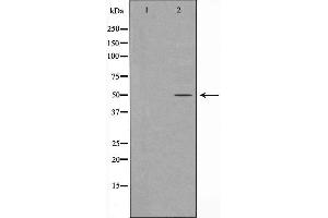 Western blot analysis of Keratin 16 expression in HepG2 cell extract. (KRT16 anticorps  (C-Term))