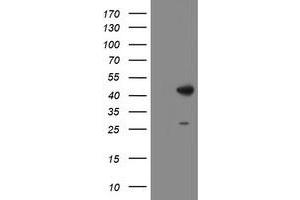 Western Blotting (WB) image for anti-Dihydrolipoamide Branched Chain Transacylase E2 (DBT) antibody (ABIN1497771) (DBT anticorps)