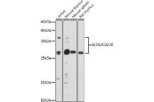 Western blot analysis of extracts of various cell lines, using ICOS/CD278 antibody (ABIN3022590, ABIN3022591, ABIN3022592, ABIN1513055 and ABIN6218929) at 1:500 dilution. (ICOS anticorps  (AA 21-140))