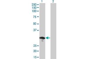 Western Blot analysis of RABL2B expression in transfected 293T cell line by RABL2B monoclonal antibody (M01), clone 1B10.