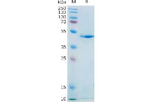 Interleukin 21 (IL21) (AA 30-162) protein (mFc Tag)