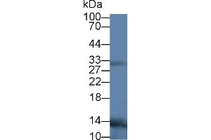 Western Blot; Sample: Human Leukocyte lysate; Primary Ab: 3µg/ml Mouse Anti-Human RANkL Antibody Second Ab: 0. (RANKL anticorps  (AA 106-240))