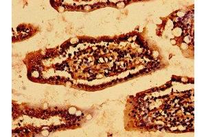Immunohistochemistry of paraffin-embedded human small intestine tissue using ABIN7157063 at dilution of 1:100