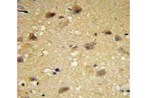 IHC analysis of FFPE human brain tissue with CCL2 antibody