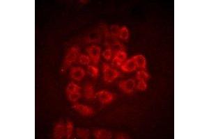 Immunofluorescent analysis of BOC staining in SW480 cells. (BOC anticorps)